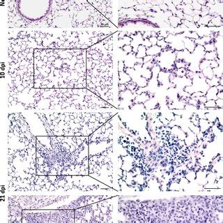 Histopathological Analysis Of Lung Tissue Of T B Brucei Infected