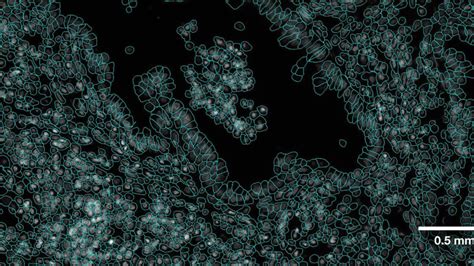 Complex Cell Segmentation And Its Significance In Spatial Biology