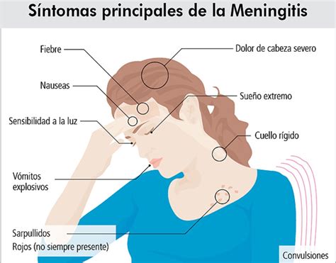 Enfermedades Infectocontagiosas Meningitis Meningococia