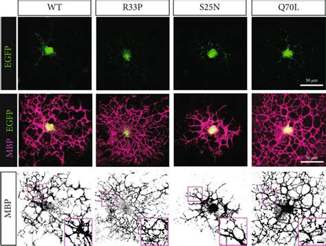 The Expressions Of RABs In Oligodendrocytes And Effect Of RAB11A R33P