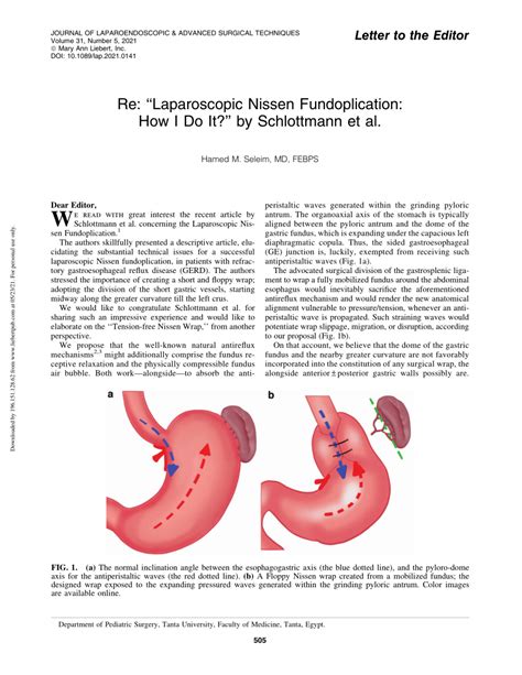 Pdf Response To Laparoscopic Nissen Fundoplication How I Do It By