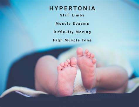 Hypertonia Information Storymd