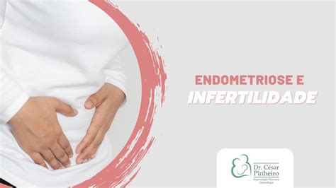 Endometriose E Infertilidade YouTube