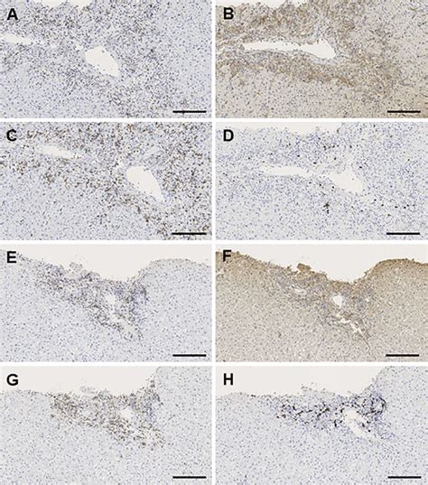 Figure3 Immunostaining Of CD3 A CD4 B CD8 C And CD20