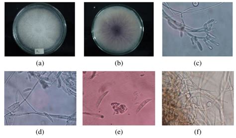 Morphological Characteristics Of Fusarium Oxysporum On Pda Note Ab