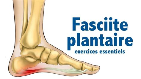 Fasciite Ou Apon Vrosite Plantaire Des Exercices Efficaces Niv