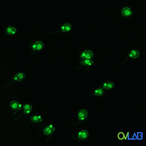 ANTI DNA NATIVO DS DOBLE CADENA OVLAB O V Laboratorios