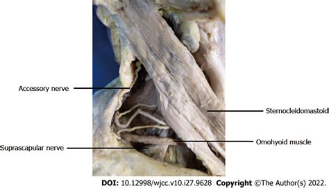 Anatomy And Clinical Application Of Suprascapular Nerve To Accessory