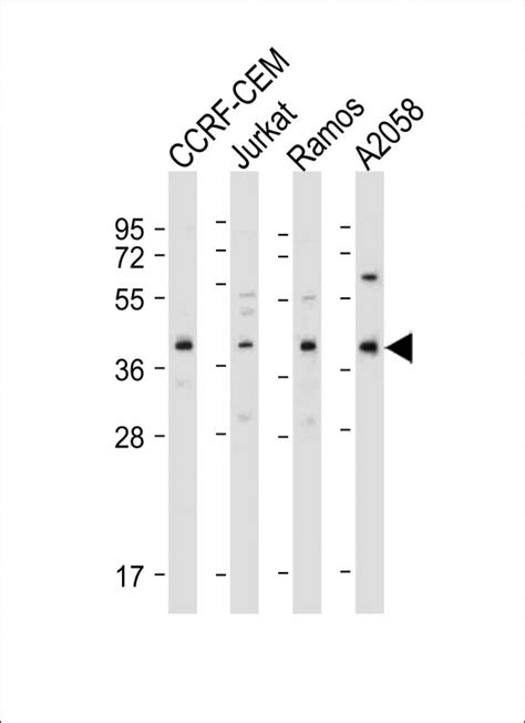 HLA B Antibody N Term Affinity Purified Rabbit Polyclonal Antibody