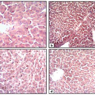 Photomicrographs Of H E Stained Rat Liver Sections The Control Rat