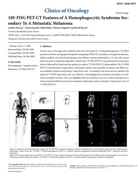 18F FDG PET CT Features Of A Hemophagocytic Syndrome Secondary To A