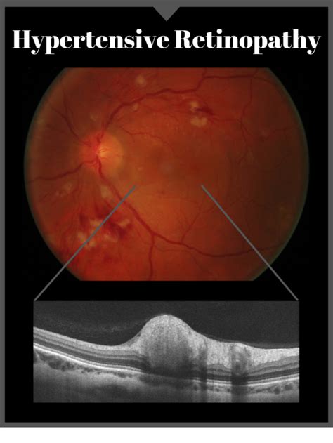 Digital Retinal Imaging Greenfield Optometry