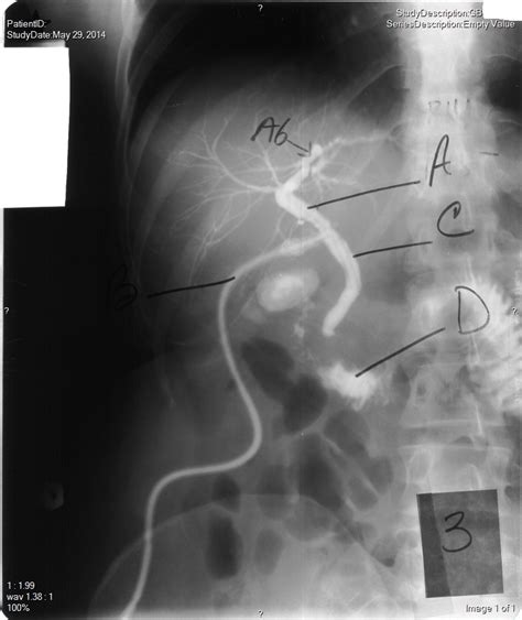 Biliary Radiograph Anatomy Diagram Quizlet