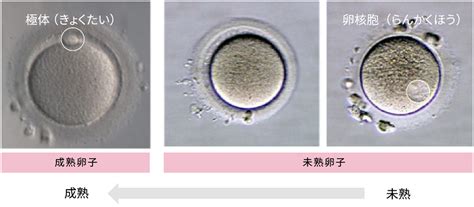 体外受精胚移植法の流れ 婦人科ウィメンズセンター 常滑市民病院