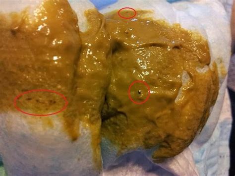 Brown Specks In Stool - Stools Item