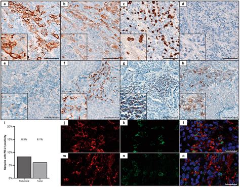 Representative Immunohistochemical Staining Patterns Of Pd L In