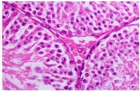 Photomicrograph Of Testes Of A Male Rat Of Group C Showing Reduced