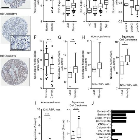 Rbpj Deficiency Increases Mammosphere Formation And Confers Resistance