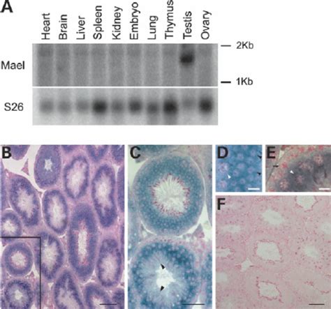 Mael Localizes To The Xy Body And The Chromatoid Body Adult Mouse