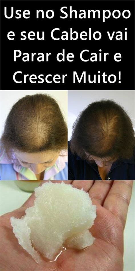 Use Isso No Shampoo E Seu Cabelo Vai Parar De Cair E Crescer Muito