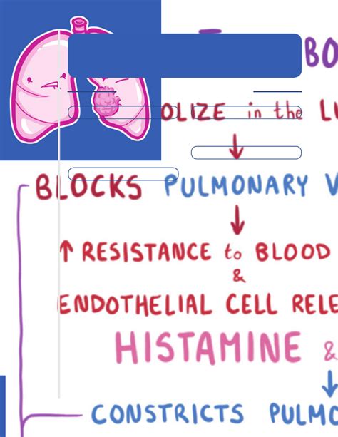 Pulmonary Vascular Disease Notes Diagrams And Illustrations Osmosis