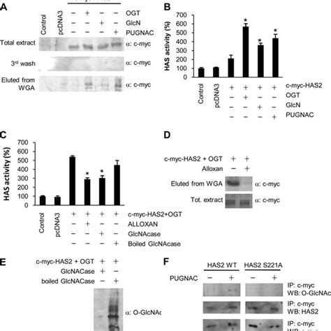 Udp Glcnac Availability Controls Gag Synthesis Whereas O Glcnacylation Download Scientific