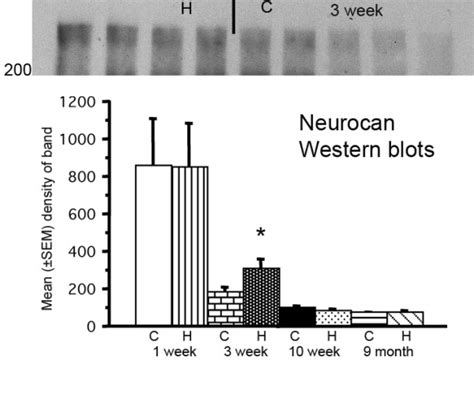 Western Blot Of Neurocan Molecular Size Upper Panel