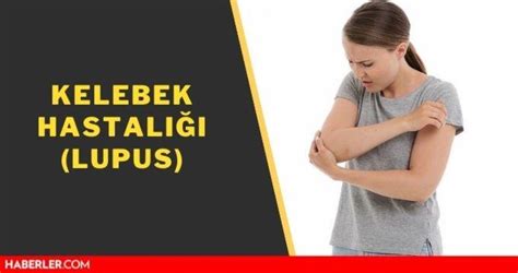 Kelebek Hastal Lupus Kelebek Hastal Nedir Sle Nedir