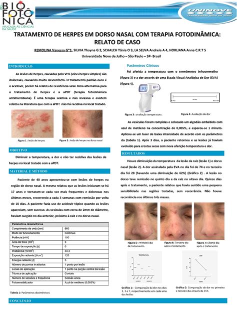 Tratamento De Herpes Em Dorso Nasal Terapia