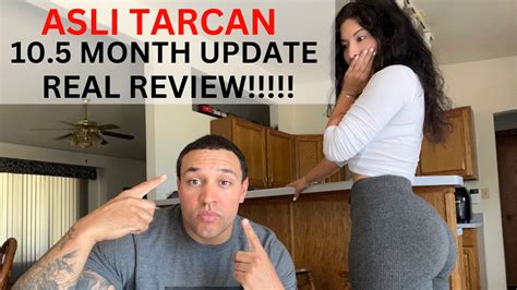 ASLI TARCAN FUE HAIR TRANSPLANT 10 5 MONTH UPDATE TAKING