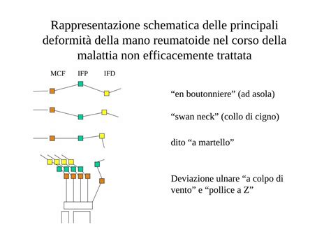 PDF Rappresentazione schematica delle principali deformità della