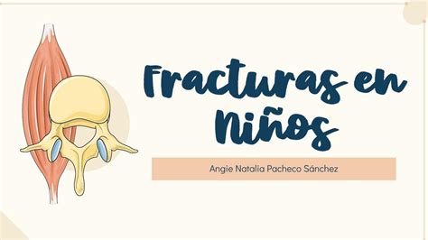 Fracturas En Ni Os Angie Pacheco Udocz