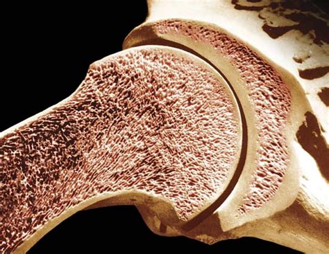 Understanding Bone Density Biostrong