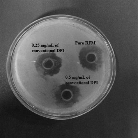 Pdf Dry Powder Inhaler Formulation Of Rifampicin An Improved