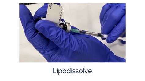 Lipodissolve Fat Reduction Injections Youtube