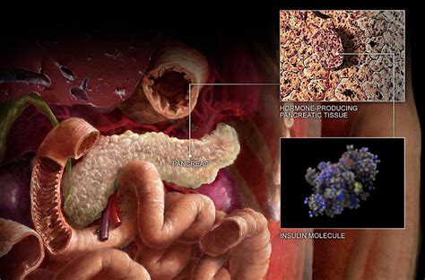 Diabetes And The Pancreas Photograph by Anatomical Travelogue - Fine ...