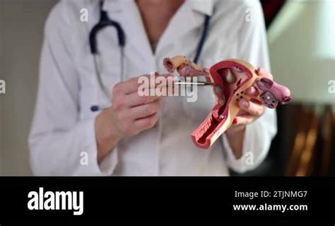 Gynecologist Shows Closeup On Plastic Model Of Uterus And Ovaries