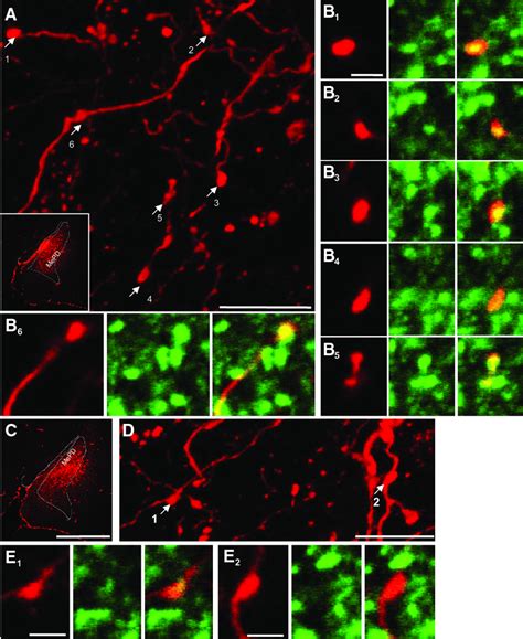 Combination Of Immunostaining Against Vglut2 And Gad6567 And