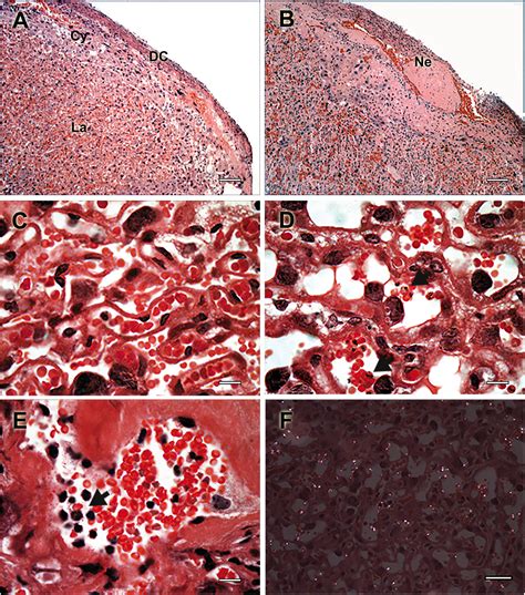 Frontiers Contribution Of Murine Models To The Study Of Malaria