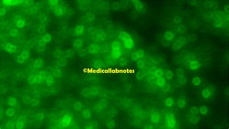 Streptococcus pneumoniae: Introduction, Morphology, Pathogen