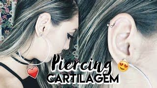 Como Tratar Queloide Na Orelha Piercing