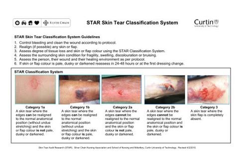 STAR Skin Tear Classification System - Silver Chain