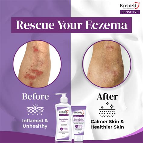 Bioshield Sensitive Dermarelief Lotion 230ml ZÉra