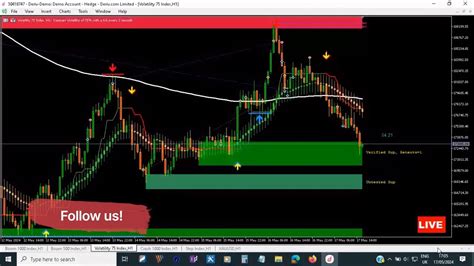 VIX 75 Live Trading Signals Volatility75 Killer Signals YouTube