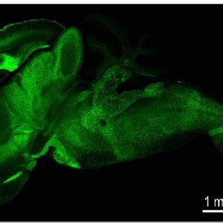 Expression of channelrhodopsin-2 (ChR2) in layer 5 pyramidal neurons in... | Download Scientific ...