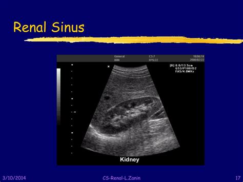 PPT - Sectional Anatomy PowerPoint Presentation, free download - ID:101056