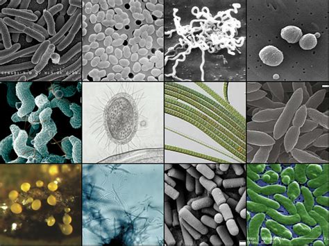 Contaminación y microorganismos Quizizz