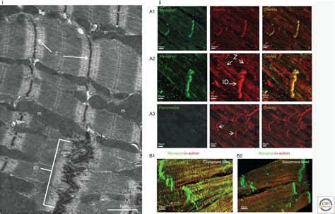 Type Iii Intermediate Filaments Desmin Glial Fibrillary Acidic Protein