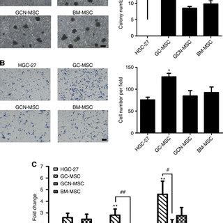 Gc Msc Exosomes Promote Cells Proliferation And Migration Via