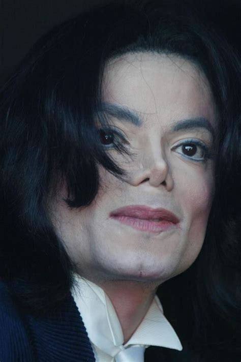 I have the Michael Jackson skin condition – The Irish Times